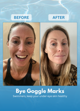 Goggle Marks Soothing Gel